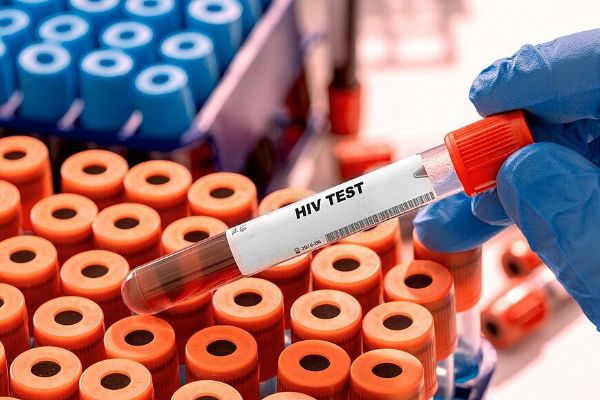 HIV v Česku dál přibývá. Případy nejsou jen ve velkých městech, týkají se i {kraj_2}