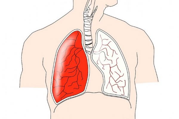 S respiračními onemocněními si poradí studená inhalace